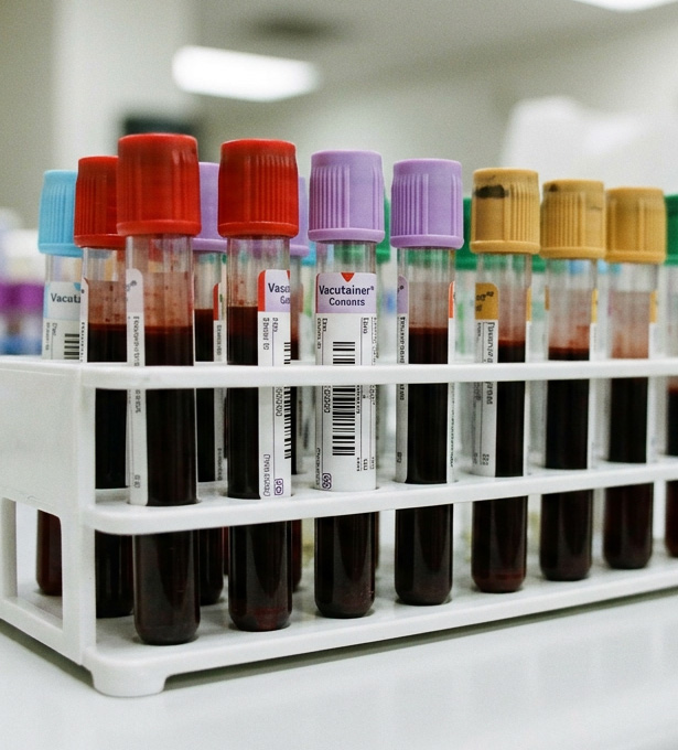 labordiagnostik tubes